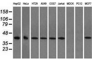 Western blot analysis of extracts (35 µg) from 9 different cell lines by using anti-ACAT2 monoclonal antibody. (ACAT2 antibody)