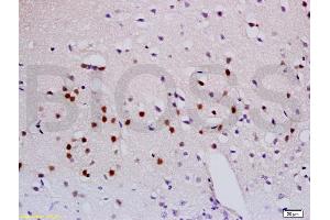 Formalin-fixed and paraffin embedded mouse brain labeled with Anti-Sema3A Polyclonal Antibody, Unconjugated (ABIN737961) at 1:200 followed by conjugation to the secondary antibody and DAB staining. (SEMA3A antibody  (AA 22-120))