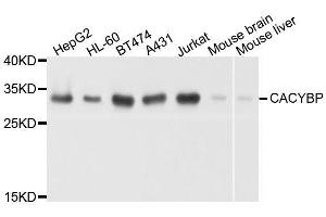 Western blot analysis of extracts of various cell lines, using CACYBP antibody. (CACYBP antibody  (AA 1-228))
