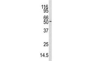 Western blot analysis of CAMKK antibody and mouse cerebellum tissue lysate. (CAMKK1 antibody  (AA 86-121))