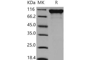 Western Blotting (WB) image for Sema Domain, Immunoglobulin Domain (Ig), Transmembrane Domain (TM) and Short Cytoplasmic Domain, (Semaphorin) 4D (SEMA4D) (Active) protein (His tag) (ABIN7320205) (SEMA4D/CD100 Protein (His tag))