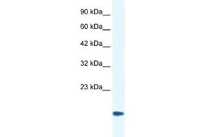 WB Suggested Anti-CSRP3 Antibody Titration:  0. (CSRP3 antibody  (Middle Region))