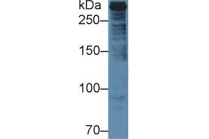 Detection of PLEC in Human U2OS cell lysate using Polyclonal Antibody to Plectin (PLEC) (PLEC antibody  (AA 175-400))