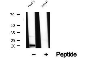 Western blot analysis of extracts of HepG2 cells, using TIM22 antibody. (TIMM22 antibody  (Internal Region))