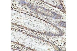 IHC analysis of DHX15/prp43 using anti-DHX15/prp43 antibody (ABIN7602738). (DHX15 antibody  (C-Term))