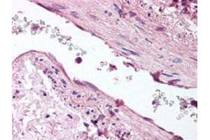 Immunohistochemical staining with Angpt1 polyclonal antibody  was diluted 1 : 500 to detect Angptl1 in human lung tissue.