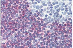 Human Tonsil (formalin-fixed, paraffin-embedded) stained with PDCD4 antibody ABIN364343 at 5 ug/ml followed by biotinylated anti-mouse IgG secondary antibody ABIN481714, alkaline phosphatase-streptavidin and chromogen. (PDCD4 antibody  (AA 1-469))