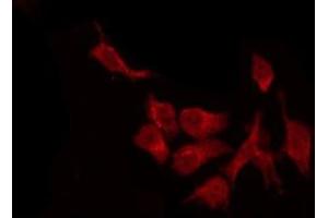 ABIN6278060 staining Hela by IF/ICC. (DFFA antibody  (C-Term))
