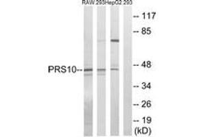 Western Blotting (WB) image for anti-Proteasome (Prosome, Macropain) 26S Subunit, ATPase, 6 (PSMC6) (AA 61-110) antibody (ABIN2890037) (PSMC6 antibody  (AA 61-110))