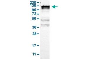 Western Blot analysis of human cell line RT-4 with KIF11 polyclonal antibody . (KIF11 antibody  (AA 373-477))