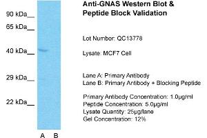 Host: Rabbit  Target Name: GNAS  Sample Tissue: MCF7 Whole Cell  Lane A:  Primary Antibody Lane B:  Primary Antibody + Blocking Peptide Primary Antibody Concentration: 1 µg/mL Peptide Concentration: 5 µg/mL Lysate Quantity: 41 µg/laneGel Concentration:. (GNAS antibody  (N-Term))