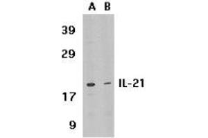 Western blot analysis of IL-21 expression in HL-60 cell lysate in the absence (lane A) or presence of blocking peptide (lane B) with AP30413PU-N IL-21 antibody at 1 μg /ml. (IL-21 antibody  (Intermediate Domain))