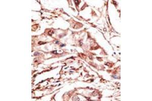 Image no. 2 for anti-Dickkopf Homolog 4 (Xenopus Laevis) (DKK4) (AA 7-36), (N-Term) antibody (ABIN357073) (DKK4 antibody  (N-Term))