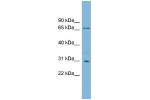 WB Suggested Anti-TBCCD1 Antibody Titration: 0. (TBCCD1 antibody  (N-Term))