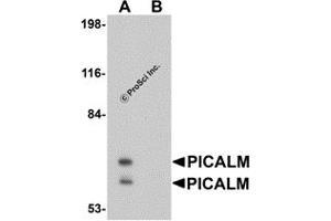 Western Blotting (WB) image for anti-Phosphatidylinositol Binding clathrin Assembly Protein (PICALM) (N-Term) antibody (ABIN1031513) (PICALM antibody  (N-Term))