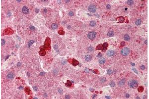 Human Liver: Formalin-Fixed, Paraffin-Embedded (FFPE) (SLC8A3 antibody  (AA 144-193))