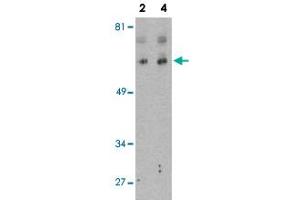 Western blot analysis of BCL2L13 in K-562 cell lysate with BCL2L13 polyclonal antibody  at 2 and 4 ug/mL . (BCL2L13 antibody  (Internal Region))