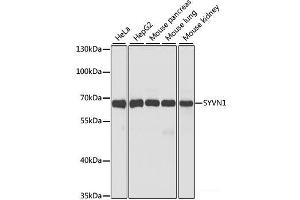 Western blot analysis of extracts of various cell lines using SYVN1 Polyclonal Antibody at dilution of 1:1000. (SYVN1 antibody)