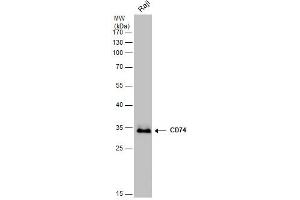 Western Blotting (WB) image for anti-HLA-DR-gamma (CD74) (N-Term) antibody (ABIN2856756)