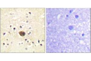 Immunohistochemistry (IHC) image for anti-Ras Protein-Specific Guanine Nucleotide-Releasing Factor 1 (RASGRF1) (AA 882-931) antibody (ABIN2888750) (RASGRF1 antibody  (AA 882-931))