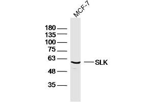 MCF-7 lysates probed with SLK Polyclonal Antibody, Unconjugated  at 1:300 dilution and 4˚C overnight incubation. (SLK antibody  (AA 165-270))