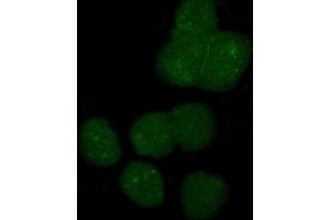 anti-Apolipoprotein B mRNA Editing Enzyme, Catalytic Polypeptide-Like 3G (APOBEC3G) (AA 191-384) antibody