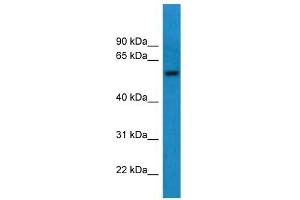 Western Blot showing CNDP1 antibody used at a concentration of 1-2 ug/ml to detect its target protein. (CNDP1 antibody  (C-Term))