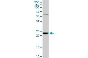 GSTK1 MaxPab rabbit polyclonal antibody. (GSTK1 antibody  (AA 1-226))