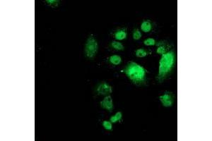 Anti-CDK2 mouse monoclonal antibody (ABIN2454523) immunofluorescent staining of COS7 cells transiently transfected by pCMV6-ENTRY CDK2 (RC200494). (CDK2 antibody)