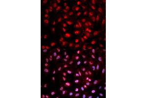 Immunofluorescence analysis of MCF-7 cells using Phospho-Dnmt1-pY399 antibody (ABIN5969883). (DNMT1 antibody  (pPpY399))