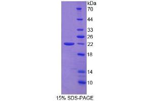 SDS-PAGE analysis of Human vWFCP Protein. (ADAMTS13 Protein)