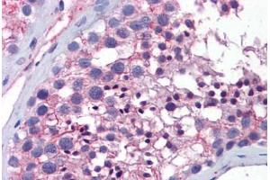 Human Testis: Formalin-Fixed, Paraffin-Embedded (FFPE) (WNT10A antibody  (AA 101-150))