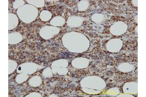 Immunoperoxidase of monoclonal antibody to HLA-DMA on formalin-fixed paraffin-embedded human malignant lymphoma, diffuse large B tissue. (HLA-DMA antibody  (AA 1-261))