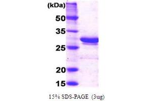 SDS-PAGE (SDS) image for Complement Component 1, Q Subcomponent Binding Protein (C1QBP) (AA 74-282) protein (ABIN666710)