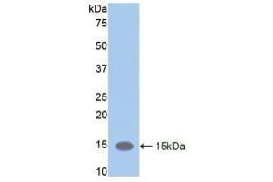 Western blot analysis of recombinant Mouse LIFR. (LIFR antibody  (AA 381-485))