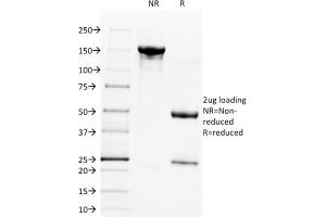 SDS-PAGE Analysis Purified CD28 Mouse Monoclonal Antibody (C28/1636). (CD28 antibody)
