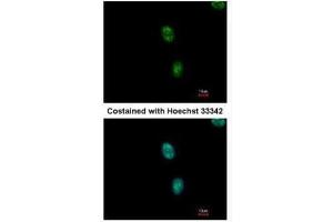 ICC/IF Image Immunofluorescence analysis of methanol-fixed HeLa, using SAP130, antibody at 1:500 dilution. (SF3B3 antibody  (C-Term))