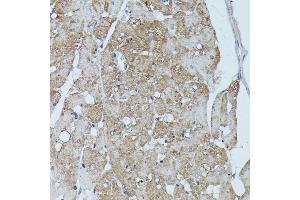 Immunohistochemistry of paraffin-embedded rat heart using FLII antibody (ABIN7267217) at dilution of 1:100 (40x lens). (FLII antibody  (AA 400-660))