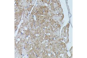 Immunohistochemistry of paraffin-embedded rat heart using FLII antibody (ABIN7267217) at dilution of 1:100 (40x lens).