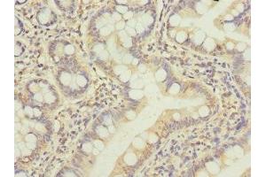 Immunohistochemistry of paraffin-embedded human small intestine tissue using ABIN7145307 at dilution of 1:100 (BCL2-Like 15 antibody  (AA 1-163))