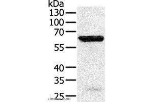 Western blot analysis of Jurkat cell, using TRAF5 Polyclonal Antibody at dilution of 1:450 (TRAF5 antibody)