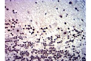 Immunohistochemical analysis of paraffin-embedded cerebellum tissues using MYCN mouse mAb with DAB staining. (MYCN antibody  (AA 337-464))