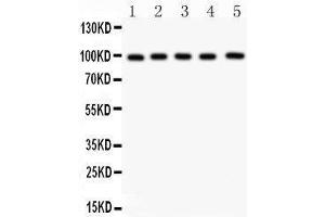 Anti- ASPH Picoband antibody, Western blotting All lanes: Anti ASPH  at 0. (Aspartate beta Hydroxylase antibody  (C-Term))