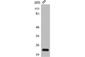 Western Blot analysis of 293 cells using Trypsin-1 Polyclonal Antibody (PRSS1 antibody  (Internal Region))