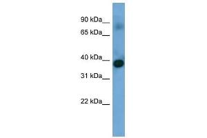 Western Blot showing SFXN4 antibody used at a concentration of 1-2 ug/ml to detect its target protein. (Sideroflexin 4 antibody  (N-Term))