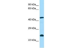WB Suggested Anti-INPP5A Antibody Titration: 1. (INPP5A antibody  (C-Term))