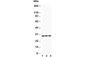 Western blot testing of ATF1 antibody and Lane 1:  rat spleen;  2: HeLa;  3: COLO320 (AFT1 antibody  (AA 1-271))