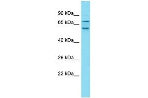 Host: Rabbit Target Name: CXorf30 Sample Type: Fetal Liver lysates Antibody Dilution: 1. (CXorf22 antibody  (C-Term))