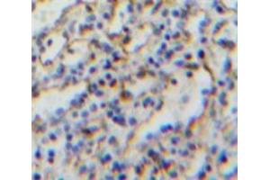 IHC-P analysis of Spleen tissue, with DAB staining. (CD21 antibody  (AA 729-957))
