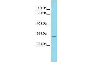 Host: Rabbit Target Name: C17orf77 Sample Type: RPMI-8226 Whole Cell lysates Antibody Dilution: 1. (C17ORF77 antibody  (C-Term))